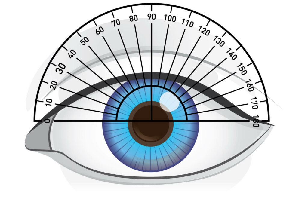 An image of an eye with a protractor overtop to show the angles in the eye that correspond with astigmatism.