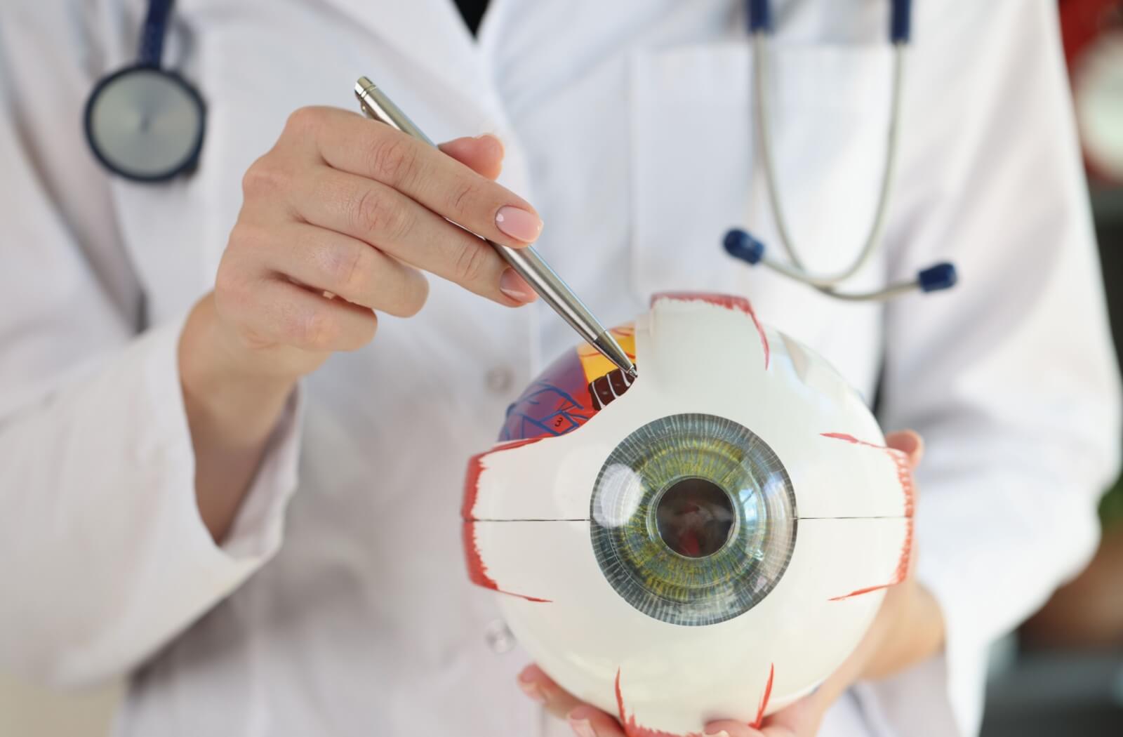 An optometrist holds an anatomical model of the human eye.