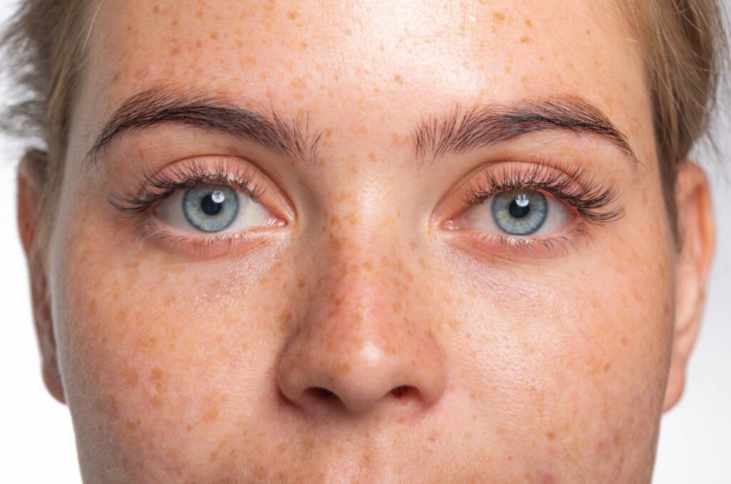 A person with striking blue eyes and freckles across their cheeks looks intensely into the camera.