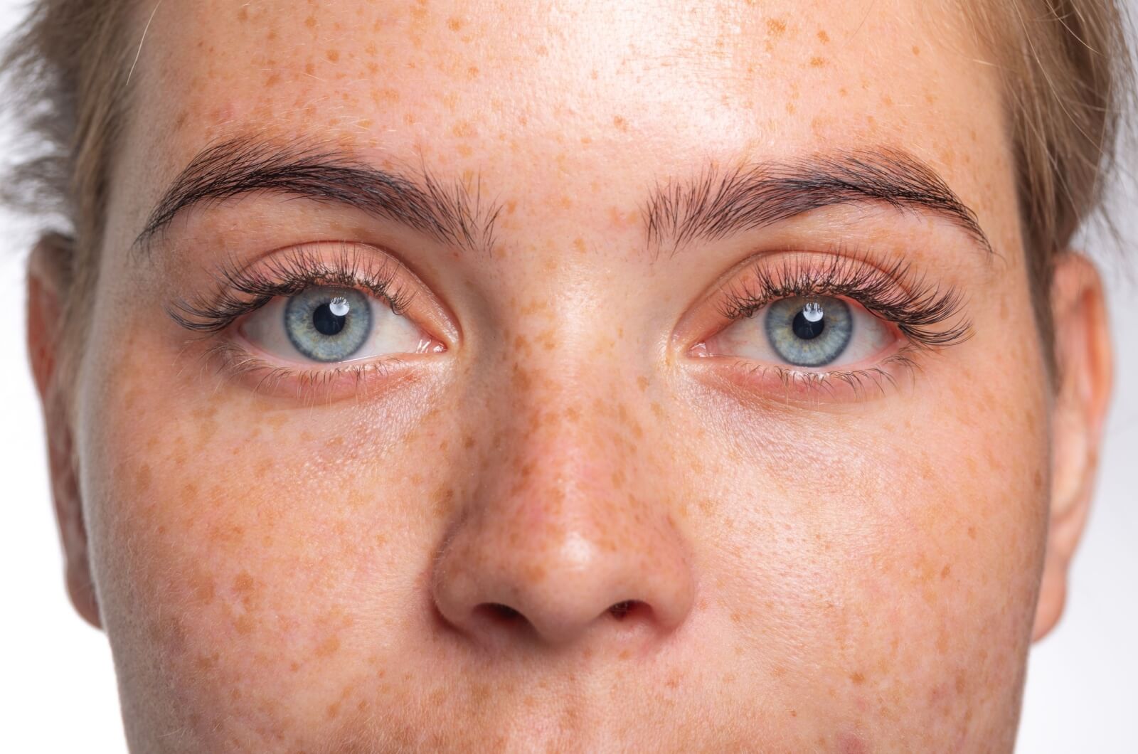 A person with striking blue eyes and freckles across their cheeks looks intensely into the camera.