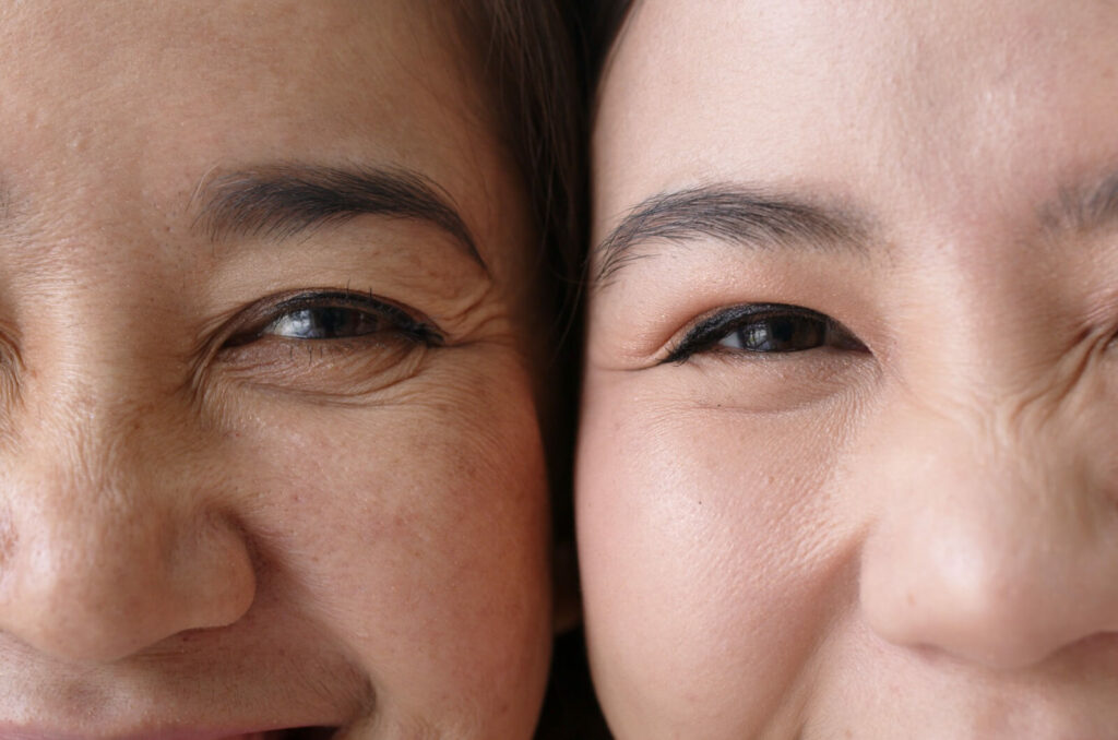 Close-up of a young woman and an older woman's eyes, representing familial ties in glaucoma.