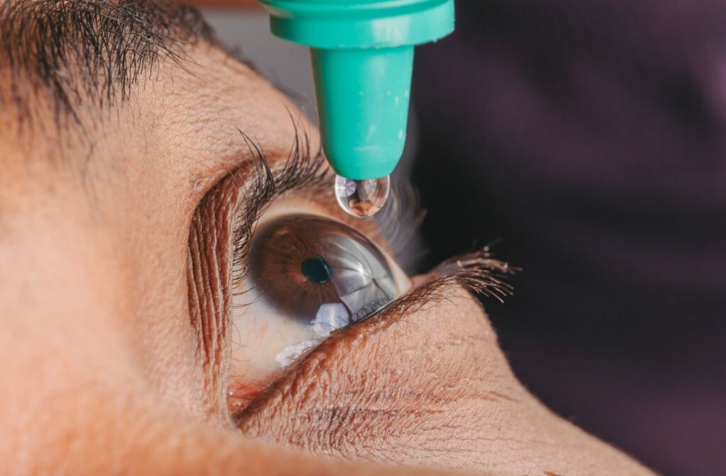 A close-up image of someone putting eye drops in their eye.
